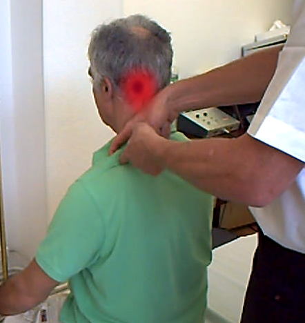 Traitement_point_trigger_trapeze_superieur_gauche_point_claviculaire